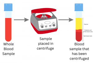 Schematic showing how whole blood separates into different components after centrifugation