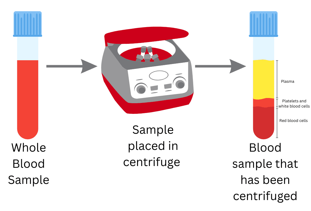 Schéma montrant comment le sang total se sépare en différents composants après centrifugation