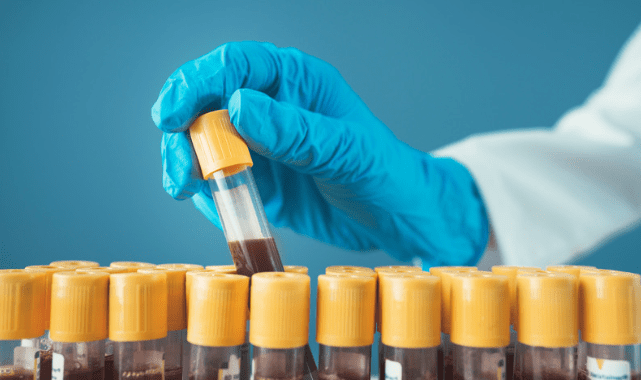 storage of blood in blood bank duration time varies depending on the component. Storage of blood products in freezers drastically extends their shelf life.